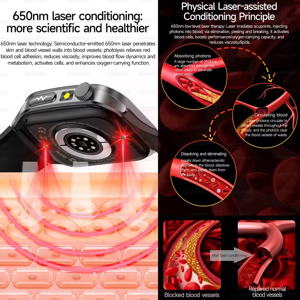 Jam Tangan Pintar Kesehatan Te - Industrial Laser Beam ulasan dan harga